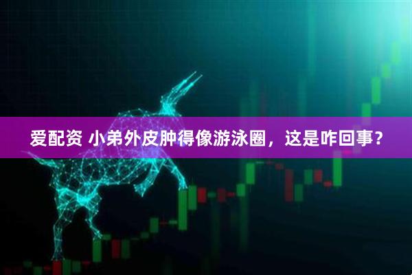 爱配资 小弟外皮肿得像游泳圈，这是咋回事？